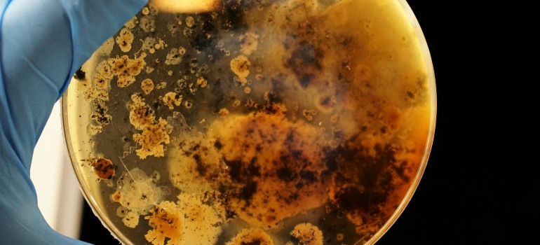 a hand holding a petri dish with bacteria that immune peptides help reduce