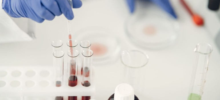 Laboratory blood samples for IGF-1 and GH peptides analysis